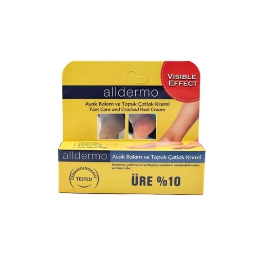 ALLDERMO AYAK VE TOPUK KREMİ 60 GR.